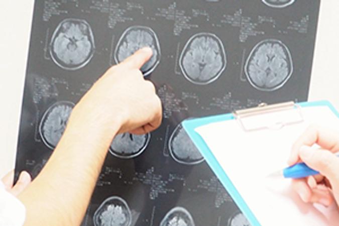 医師や他の専門家との連携のアイキャッチ
